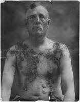 Photograph of a man facing the camera directly. His chest and shoulders are coated with tar and feathers.