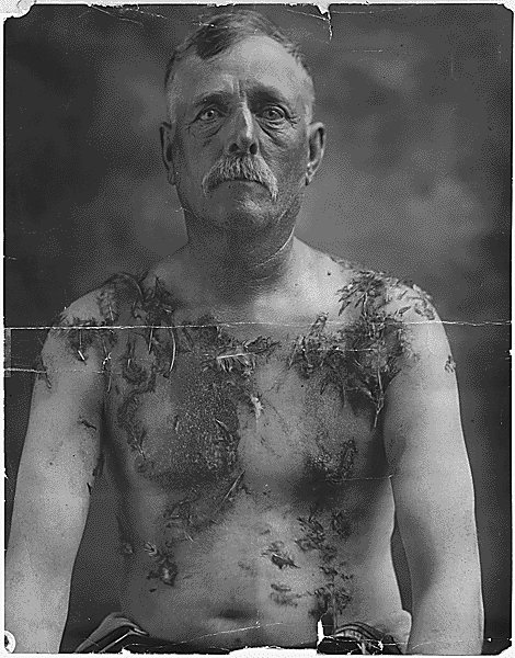 A man sits against a dark background, showing his head, arms, and upper body to the waist. His shoulders and torso show the remains of tar and feathers.